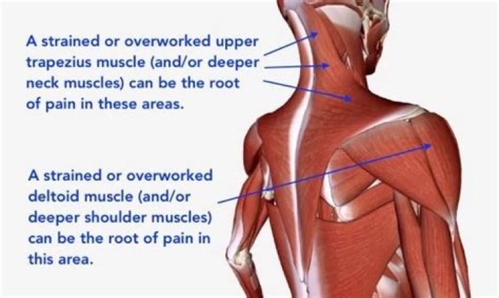 Are shoulders the weakest muscle?