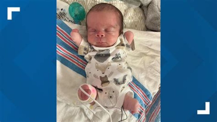 Can babies be born with gills?