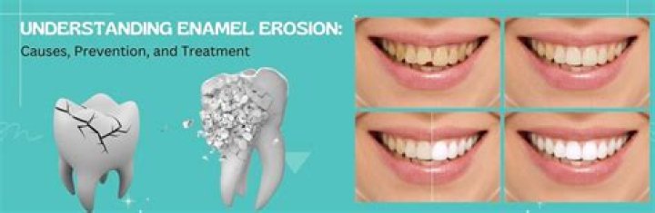 Can braces destroy enamel?