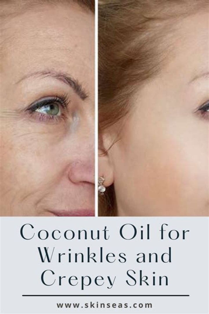 Can coconut oil remove wrinkles?
