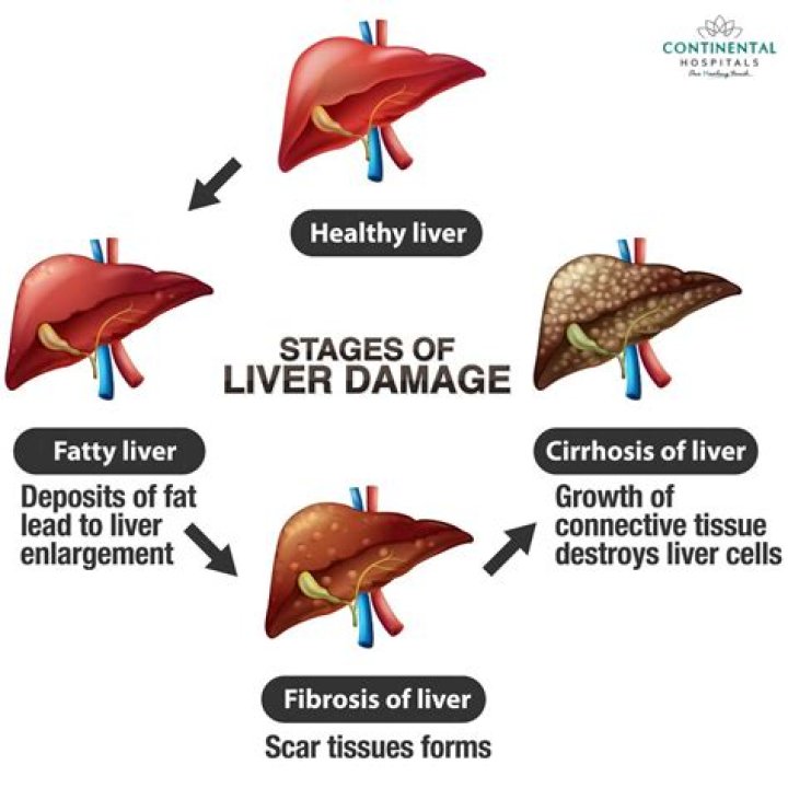 Can liver damage make you gassy?