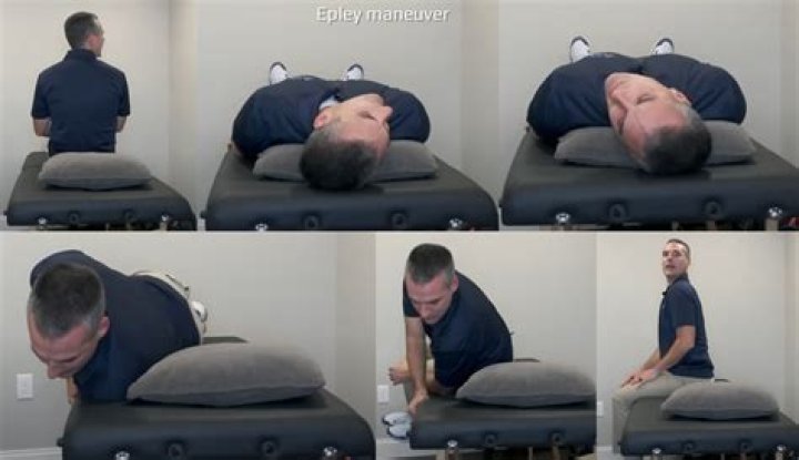 Can the Epley maneuver make you worse?