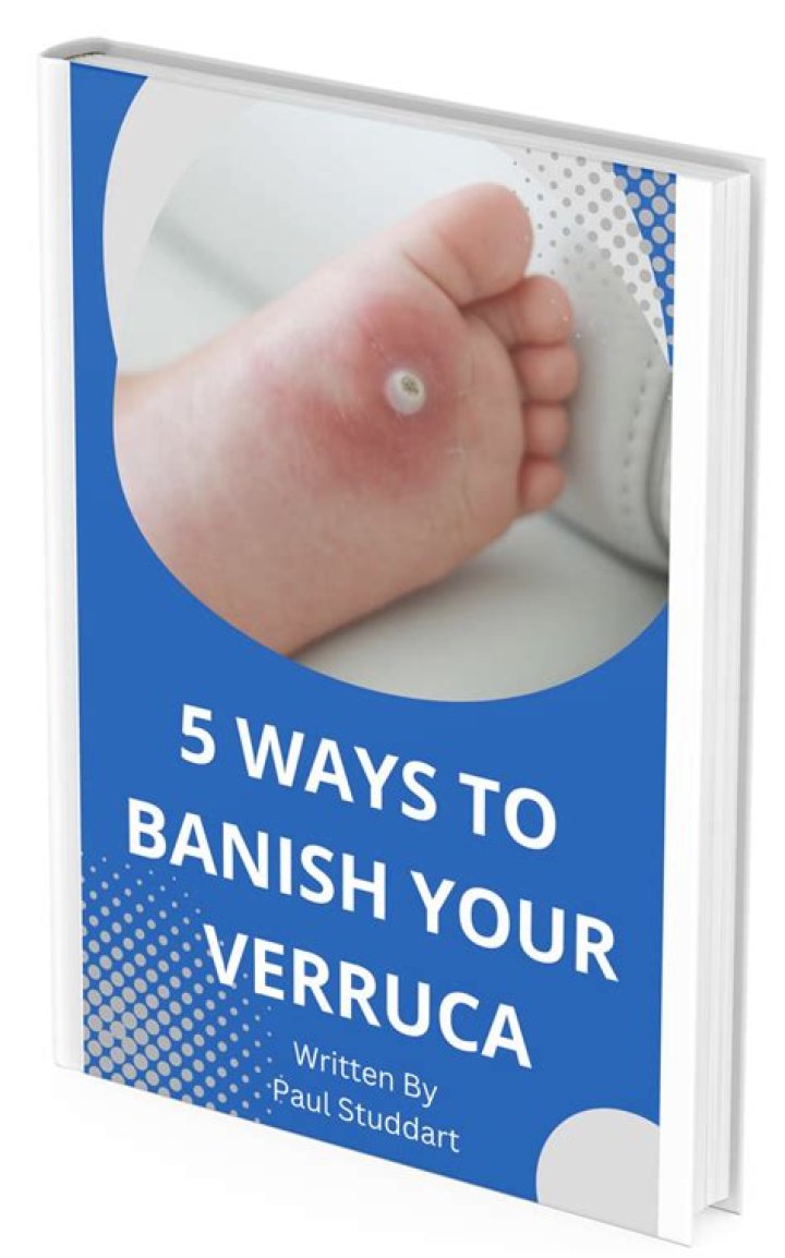 Can you dig out a verruca?
