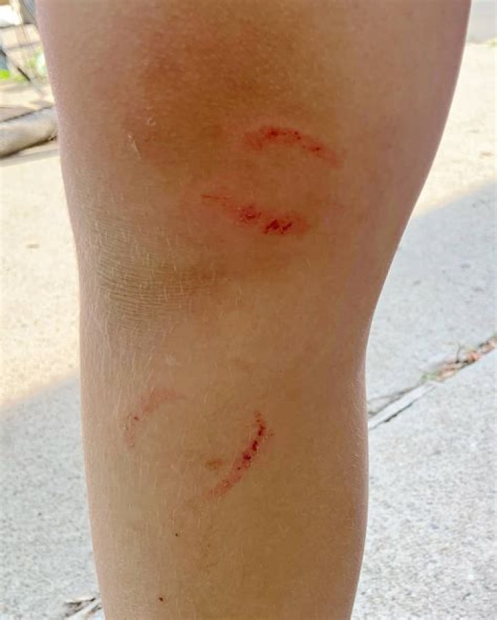 Do fish bite when they are jumping?
