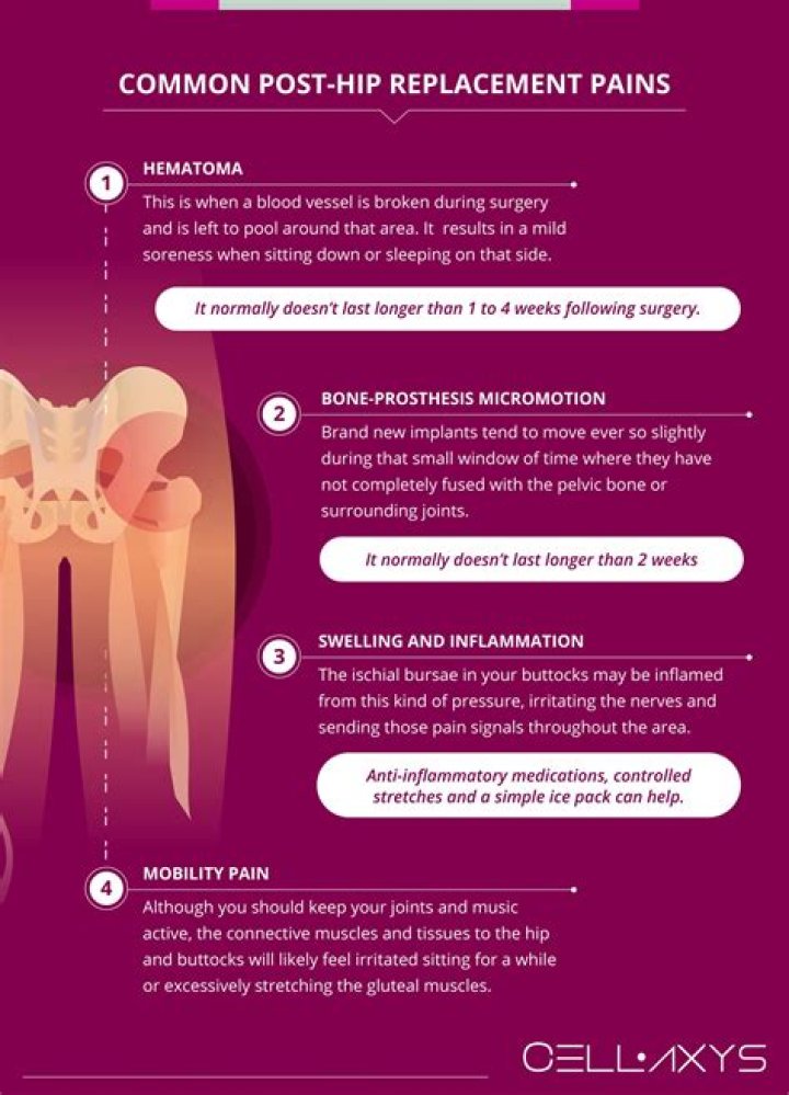 Do you get hip pain with MS?