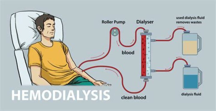 Does dialysis remove water from lungs?