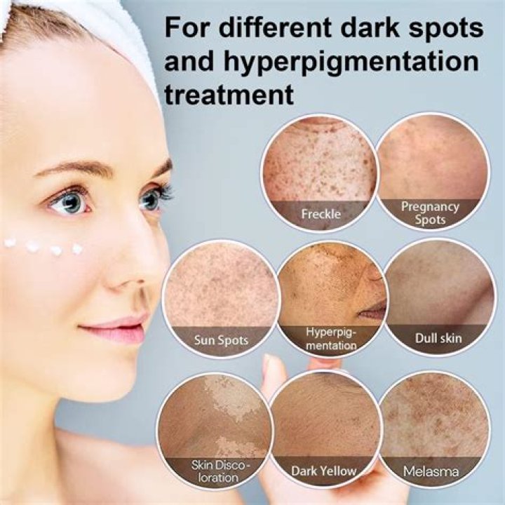 How can I remove dark spots and tan from my face?