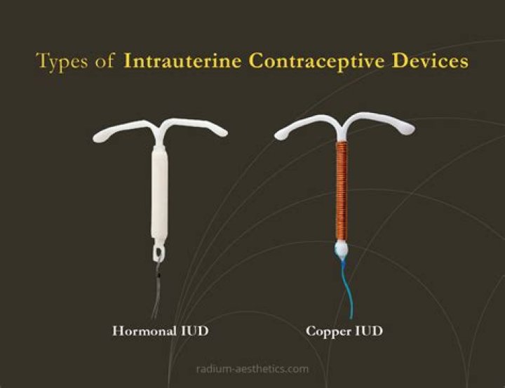 How long does IUD hurt after insertion?