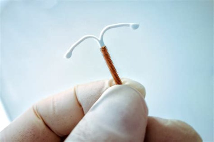 Is an IUD worth it?
