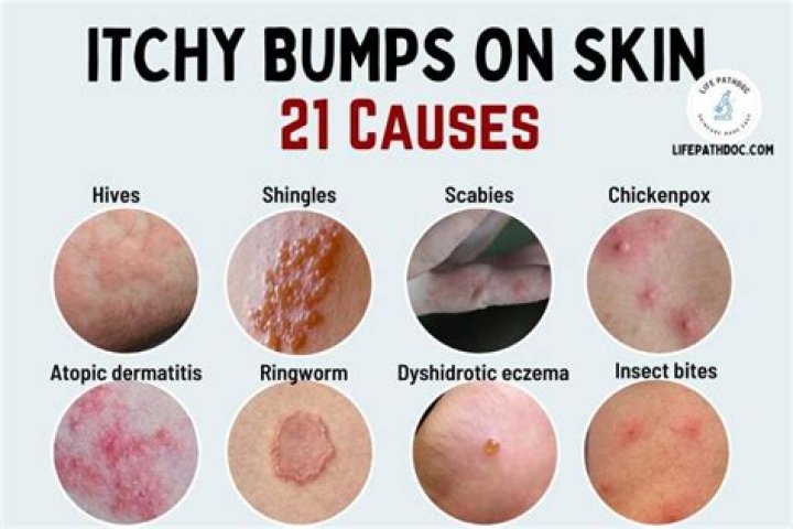 Is it normal to get bumps after waxing?
