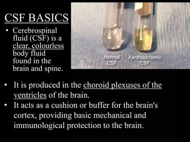 What Colour is brain fluid?