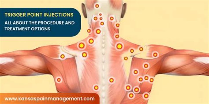 What did 1912 mean in Trigger Point?
