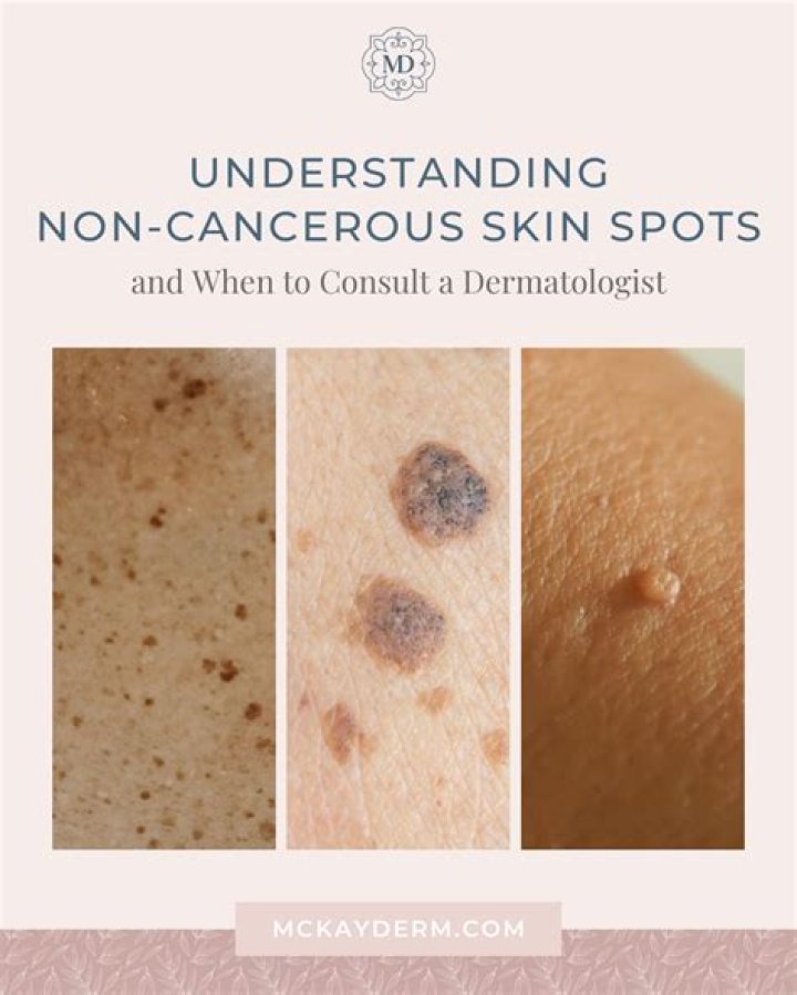What do cancerous age spots look like?