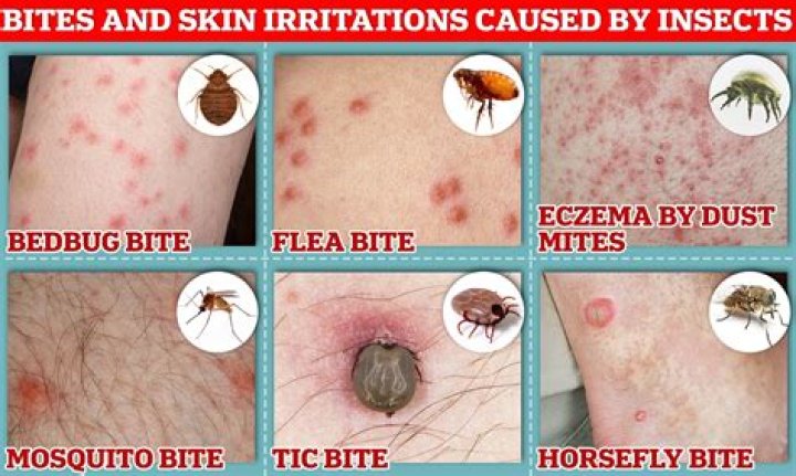 What does a bed bug bite look like?