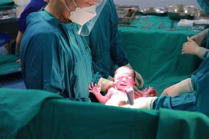 What does delivering a baby feel like?