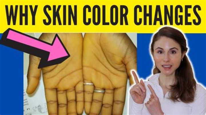 What foods change skin color?