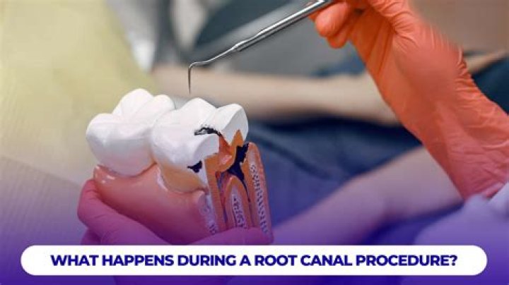 What happens during a root canal retreatment?