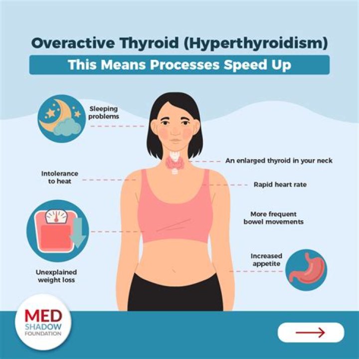 What happens if you have your thyroid removed and don't take medication?