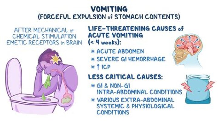 What happens if you vomit after tonsillectomy?