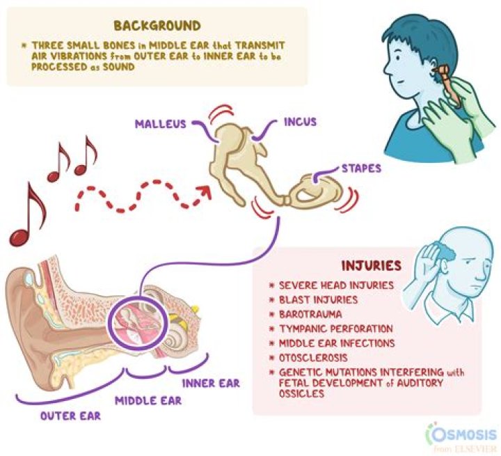 What is the crunching sound during massage?