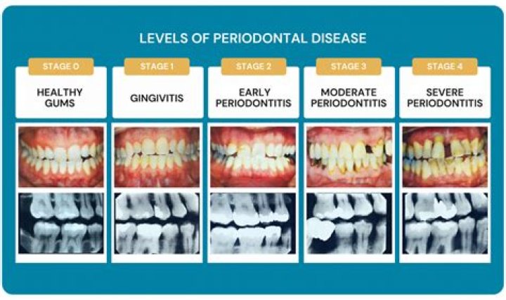 What kind of surgeries do periodontists do?