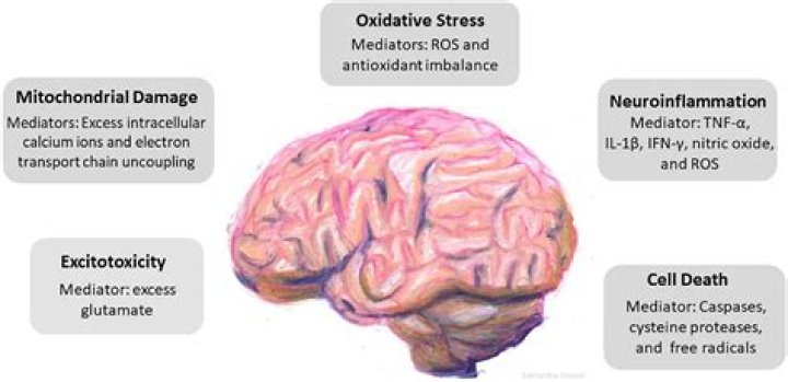 What sport causes the most brain damage?
