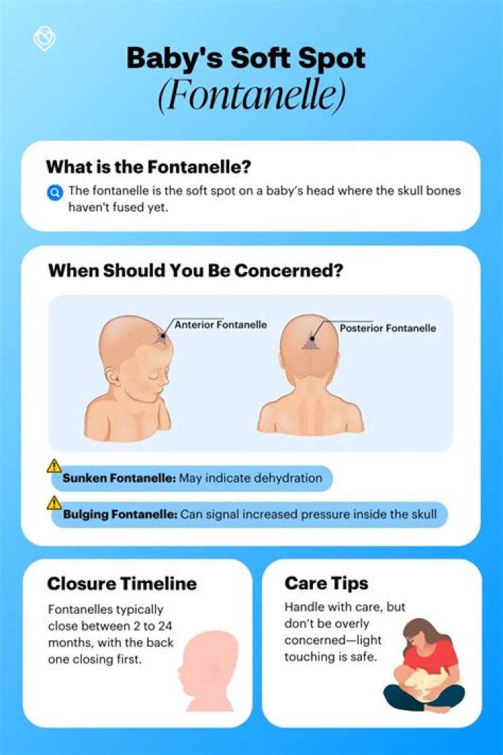 When should I be worried about a bulging soft spot?
