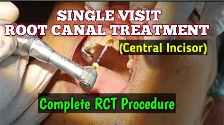 Where do I file RCT-101?