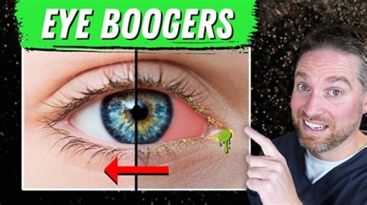 Why are my boogers dry and bloody?