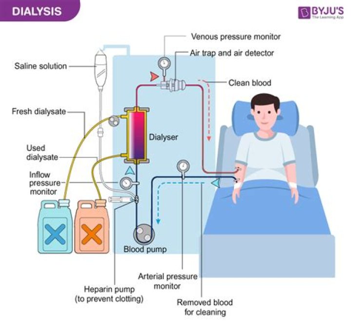 Will dialysis remove fluid from lungs?